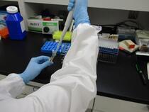 写真:HIV